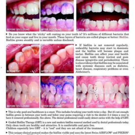 Airflow Profylaxis Master van EMS Airflow Profylaxis Master van EMS